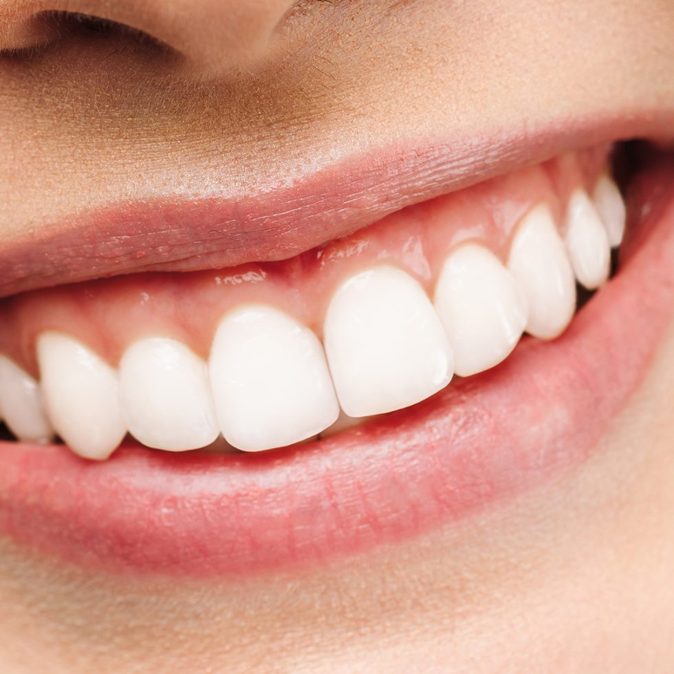 Coventry Dentist Styvechale Dental Care Affordable Dentist Coventry